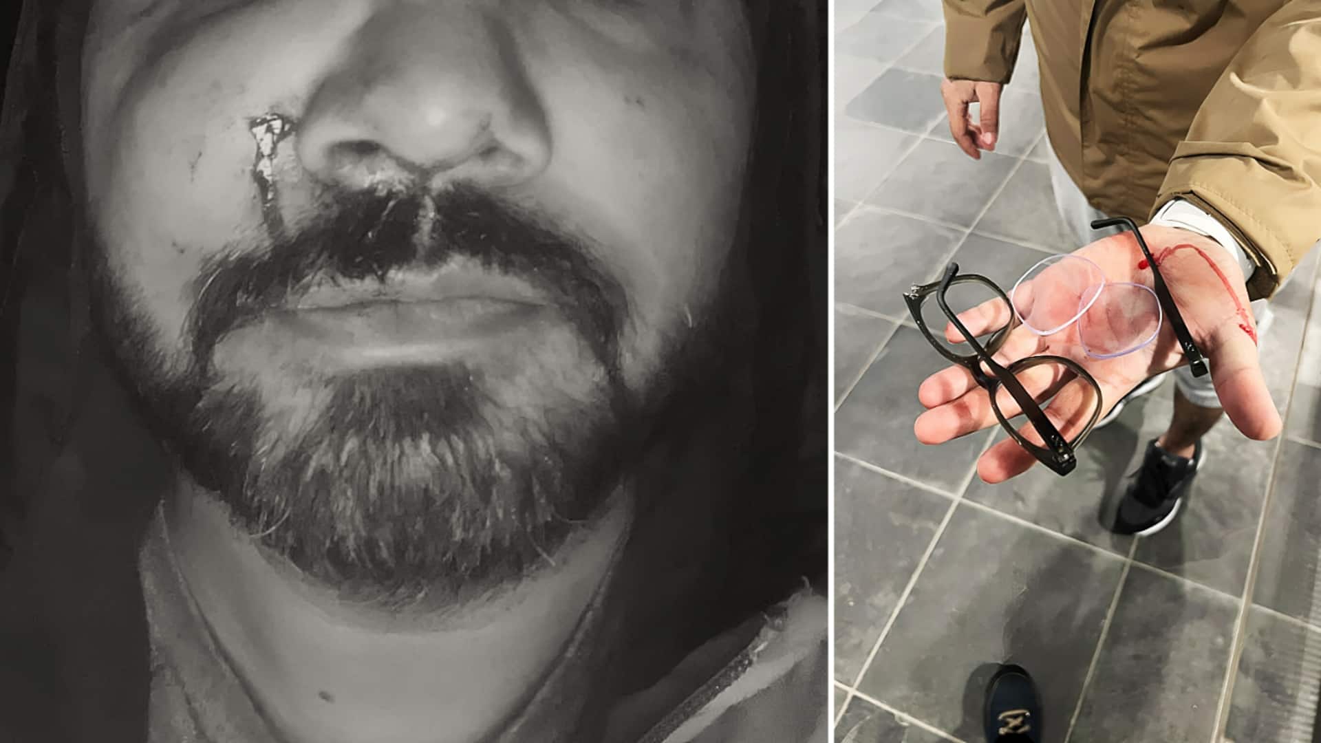 आयरलैंड के डबलिन में भारतीय मूल के व्यक्ति पर नस्लीय हमला, किशोरों के समूह ने पीटा आयरलैंड के डबलिन में भारतीय मूल के व्यक्ति पर नस्लीय हमला, किशोरों के समूह ने पीटा