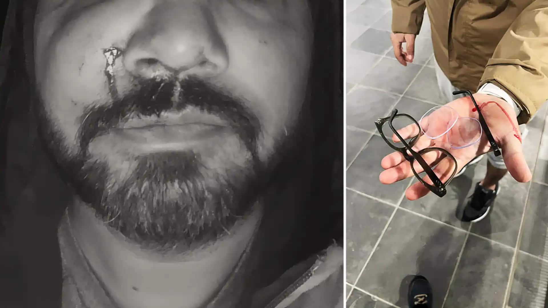 आयरलैंड में भारतीय दूतावास ने नागरिकों को दी ये सलाह, बढ़ते हमलों पर जारी की एडवायजरी आयरलैंड में भारतीय दूतावास ने नागरिकों को दी ये सलाह, बढ़ते हमलों पर जारी की एडवायजरी