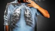 Natural ways to cleanse your lungs after quitting smoking