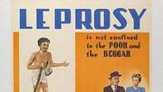 Leprosy makes a comeback in India