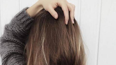#HealthBytes: Dandruff- Causes and treatment #HealthBytes: Dandruff- Causes and treatment