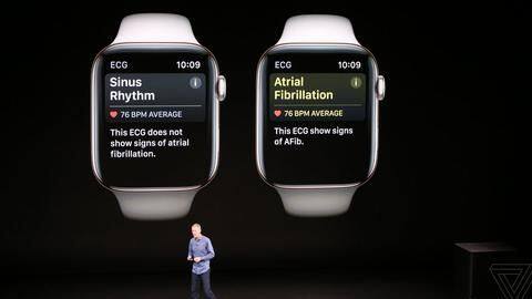 Apple Watch Series 4: World's first over-the-counter ECG device Apple Watch Series 4: World's first over-the-counter ECG device