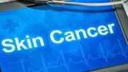 This app detects skin cancer with 95% accuracy: Details here