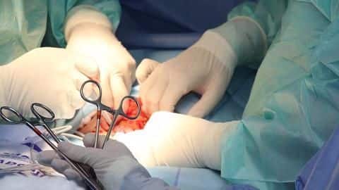 India's first attempt to separate twins joined at the head India's first attempt to separate twins joined at the head