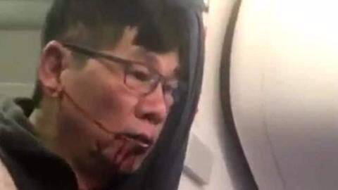 United passenger says flight ordeal worse than Vietnam War experience United passenger says flight ordeal worse than Vietnam War experience