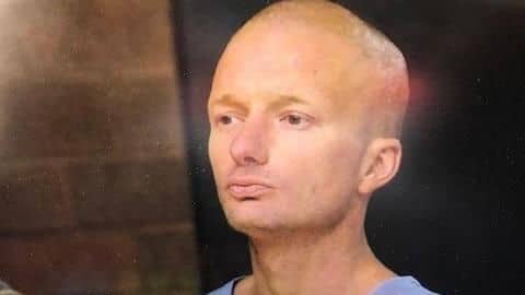 US-man bashes mother's head with baseball-bat, burns body in backyard US-man bashes mother's head with baseball-bat, burns body in backyard