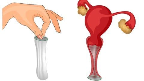 What are female condoms? What are female condoms?