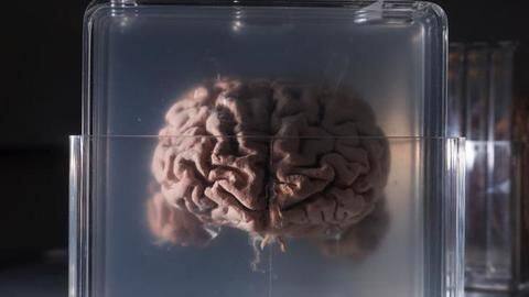Get closer to immortality with brain preservation