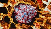 UAE researchers find mebendazole may boost gefitinib in lung cancer