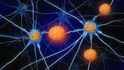 UC Santa Cruz finds P3 peptide may reshape Alzheimer's research