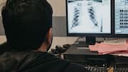 IIIT Hyderabad study warns of AI overreliance in chest X-rays