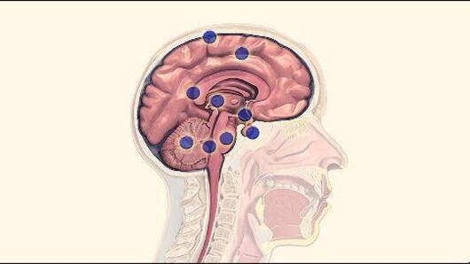 Alarming rise of brain tumor in children