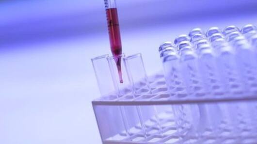 Rio Olympic sample testing lab suspension