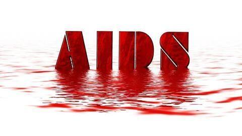 #KnowTheDisease: Everything you need to know about HIV and AIDS #KnowTheDisease: Everything you need to know about HIV and AIDS