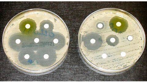 UNGA elevates antibiotic resistance to crisis level UNGA elevates antibiotic resistance to crisis level
