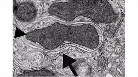 Autophagy - the vital cellular self-cannibalism act Autophagy - the vital cellular self-cannibalism act