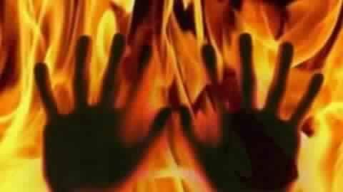 UP: Teenage girl set afire by scorned lover in Lucknow UP: Teenage girl set afire by scorned lover in Lucknow