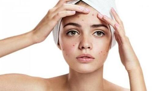 How to fight acne in summer