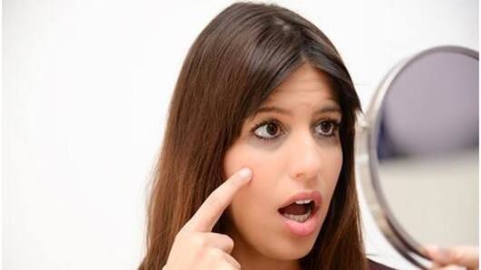 Home remedies to cure dark circles