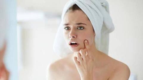 Blind pimple: What it is and how to cure it Blind pimple: What it is and how to cure it