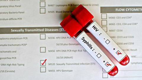 Does it prevent STIs? Will your periods be affected? Does it prevent STIs? Will your periods be affected?