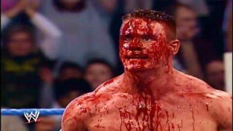 Fake sport, real pain: Major injuries suffered during WWE matches Fake sport, real pain: Major injuries suffered during WWE matches