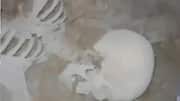 Hyderabad: Old Nokia phone helps identify 10-year-old skeleton 