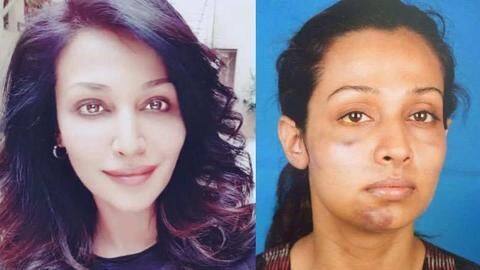 'Stree' actress Flora accuses producer Gaurang Doshi of physical abuse 'Stree' actress Flora accuses producer Gaurang Doshi of physical abuse