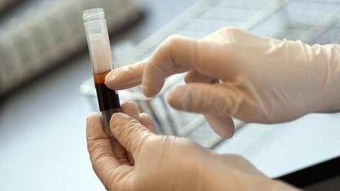 Not enough evidence to back Plasma therapy for COVID-19: Government Not enough evidence to back Plasma therapy for COVID-19: Government