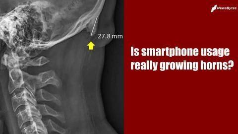 Is excessive smartphone usage really growing 'skull horns'? Is excessive smartphone usage really growing 'skull horns'?