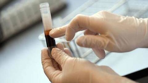 Know All About Golden Blood The Rarest Blood Type Newsbytes