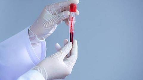 Delhi is setting up plasma bank for treating COVID-19 patients Delhi is setting up plasma bank for treating COVID-19 patients