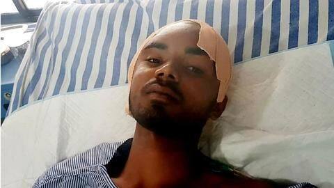 Iron rod passed through this man's skull, he miraculously survived Iron rod passed through this man's skull, he miraculously survived