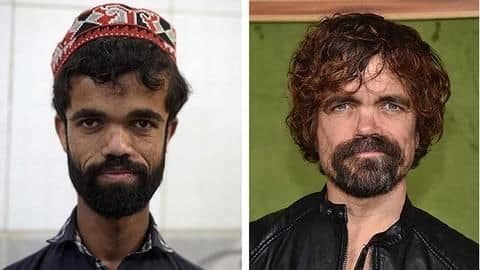 Internet has found 'GoT's Tyrion Lannister's doppelganger in Pakistan Internet has found 'GoT's Tyrion Lannister's doppelganger in Pakistan