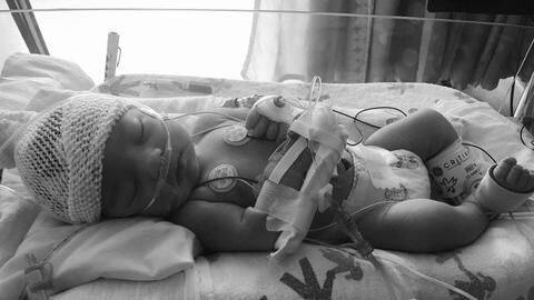 #SaveLydia: This 6-month-old suffering from genetic mutation needs help #SaveLydia: This 6-month-old suffering from genetic mutation needs help