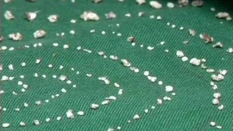 7-year-old with rare condition has 526 teeth removed from jaw 7-year-old with rare condition has 526 teeth removed from jaw