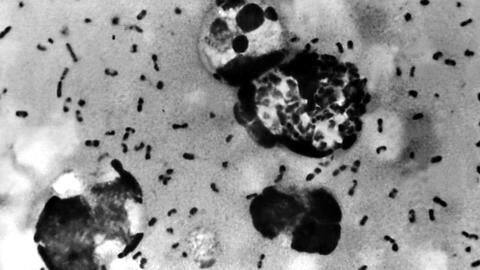 After bubonic plague death, China seals off Inner Mongolia village After bubonic plague death, China seals off Inner Mongolia village