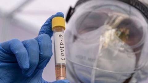 Gujarat: 3 employees of Cadila Pharmaceuticals die due to COVID-19 Gujarat: 3 employees of Cadila Pharmaceuticals die due to COVID-19