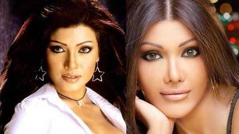 Plastic surgeries have ruined numerous celebrities in the past Plastic surgeries have ruined numerous celebrities in the past