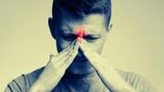 From causes to treatment, here's everything to know about sinusitis