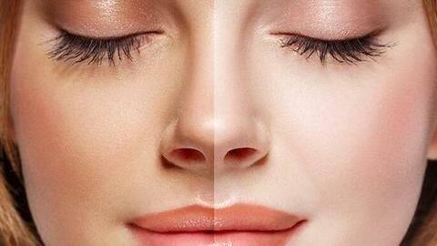Here are some home remedies to get rid of tanning Here are some home remedies to get rid of tanning