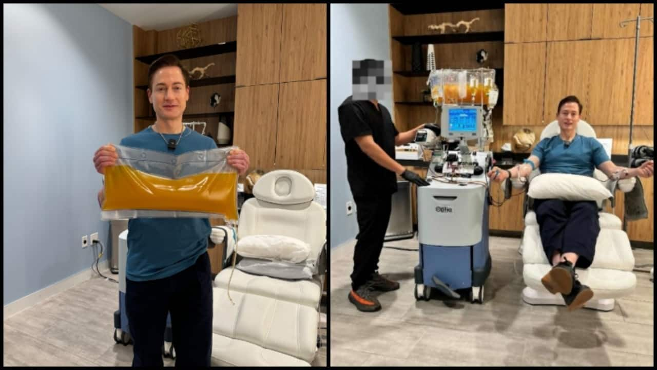 This millionaire removed plasma from his body to 'reverse' age