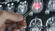 This AI model can predict your depression 4 years early