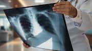 Why China's new X-ray technique is a gamechanger