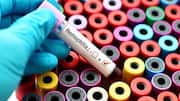 ICMR's latest test can diagnose hemophilia at just ₹580