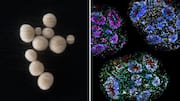 This lab-grown human brain can live for nearly 7 years