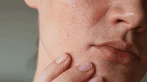 Skin care: Tips for taking care of sensitive skin Skin care: Tips for taking care of sensitive skin
