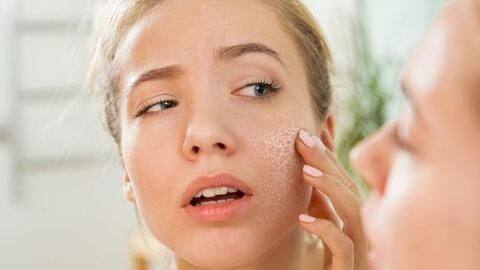 #HealthBytes: How to prevent dry skin during winter #HealthBytes: How to prevent dry skin during winter