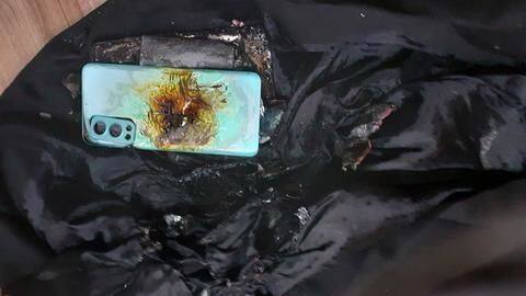 OnePlus Nord 2 5G explodes again; user injured OnePlus Nord 2 5G explodes again; user injured