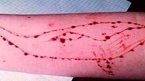 Blue Whale Challenge: Delhi-NCR schools ask parents to be careful Blue Whale Challenge: Delhi-NCR schools ask parents to be careful